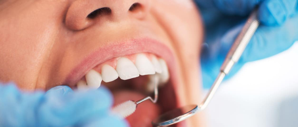 Zahnchirurgie - Zahnarzt schaut in offenen Mund