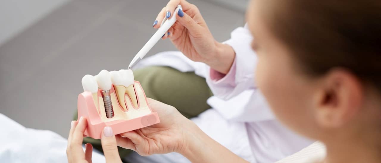 Implantologie - Zahnimplantat Modell wird erklärt